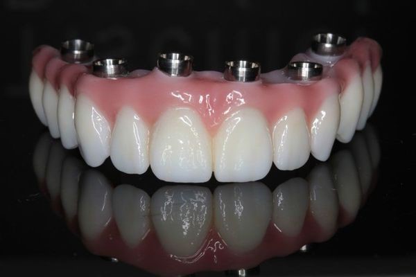 Wax Try In 
      Dentures Sharon WV 25182